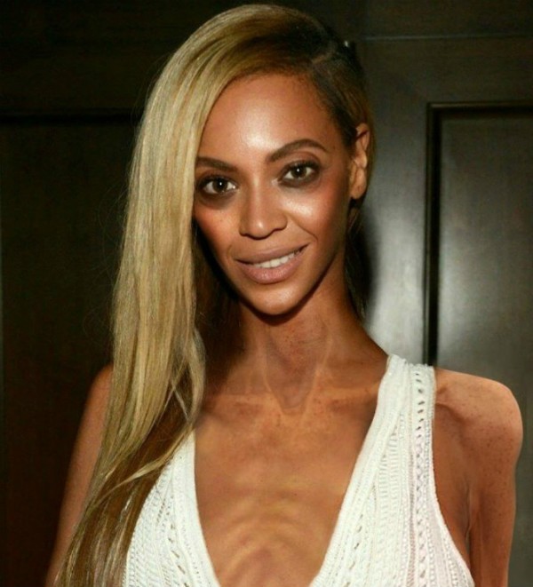 Shocking: zo zien celebs eruit als ze anorexia zouden hebben - Beyonce